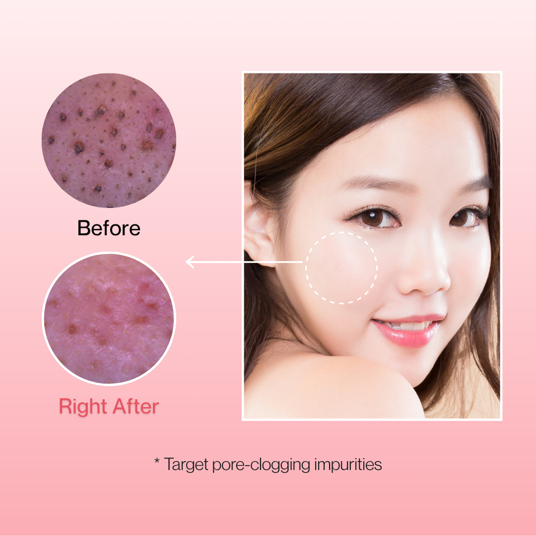 PDRN Complete 5-Step Glass Skin System